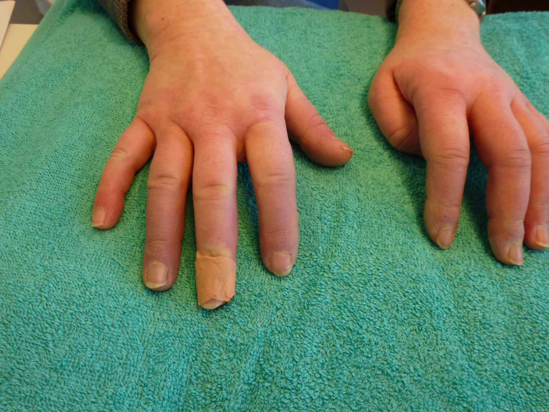 Blog Image iris clinics