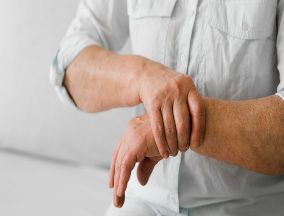 Rheumatoid Arthritis