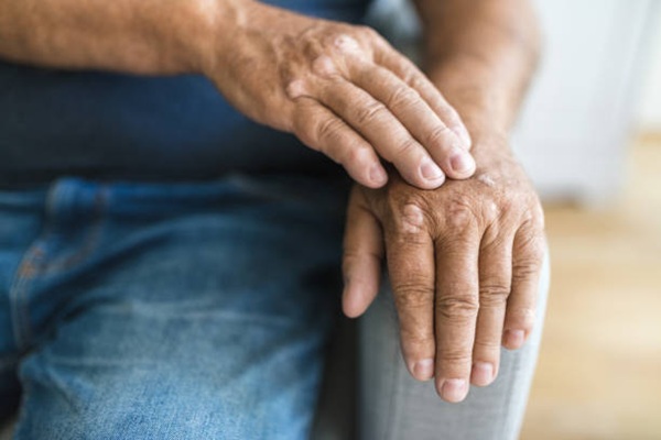 Psoriatic Arthritis                  symptoms