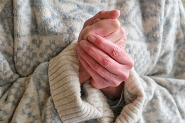 Mixed Connective Tissue Diseases                symptoms