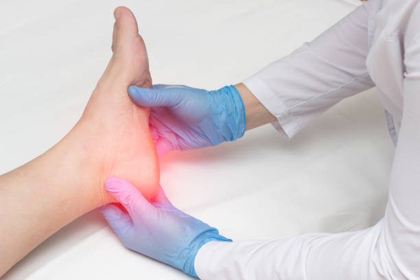 Plantar Fasciitis symptoms