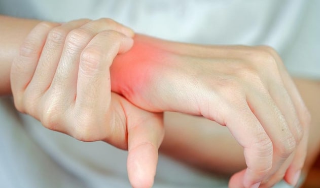 Rheumatoid Arthritis: A visual representation of the condition, highlighting joint inflammation and pain