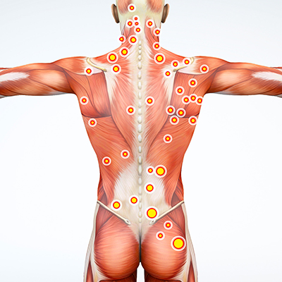 Mixed Connective Tissue Diseases