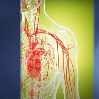 Systemic Sclerosis